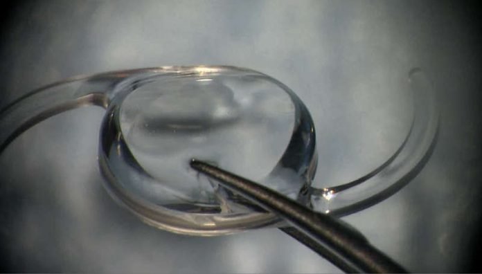 Einzigartige Linse zur Korrektur von 40 Dioptrien Zylinderwert (Foto: Universitätsmedizin Mainz)